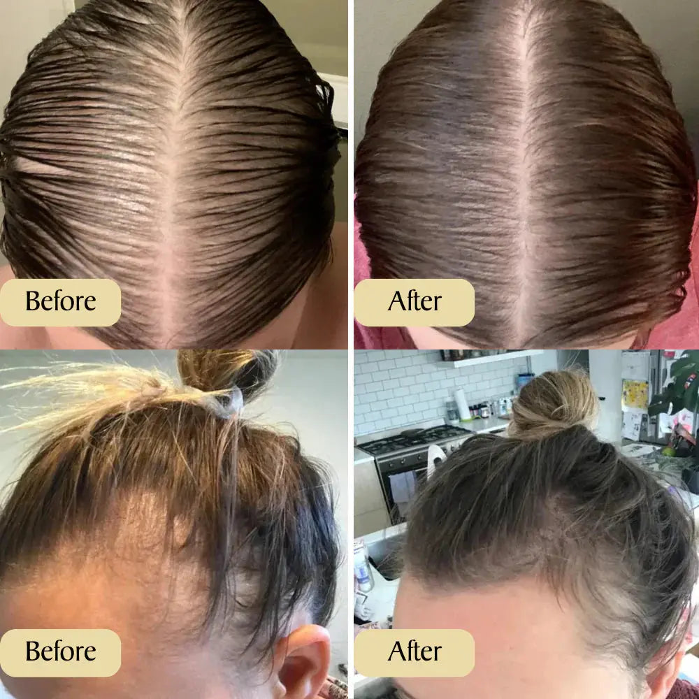 VeganicGrow Natural Hair Growth Oil 1+1 GRATIS Selene Nordic