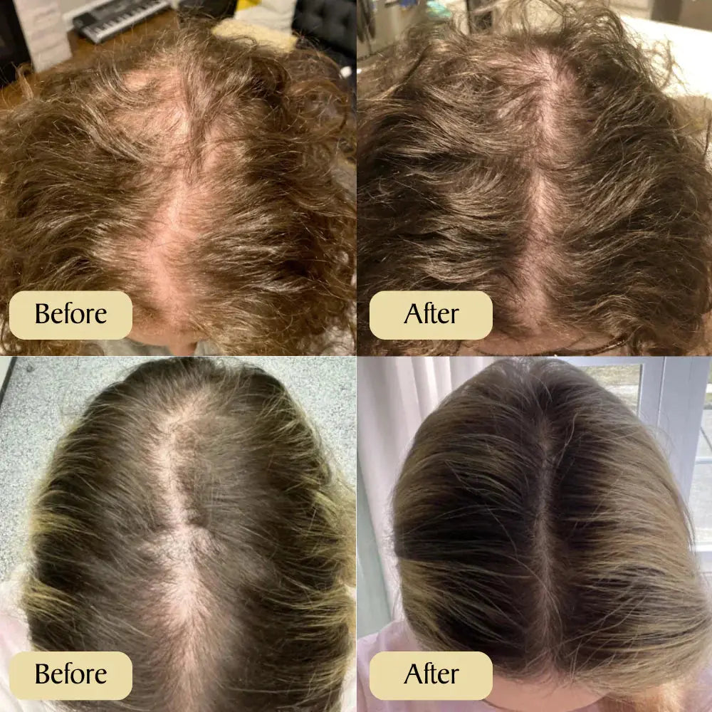 VeganicGrow Natural Hair Growth Oil 1+1 GRATIS Selene Nordic