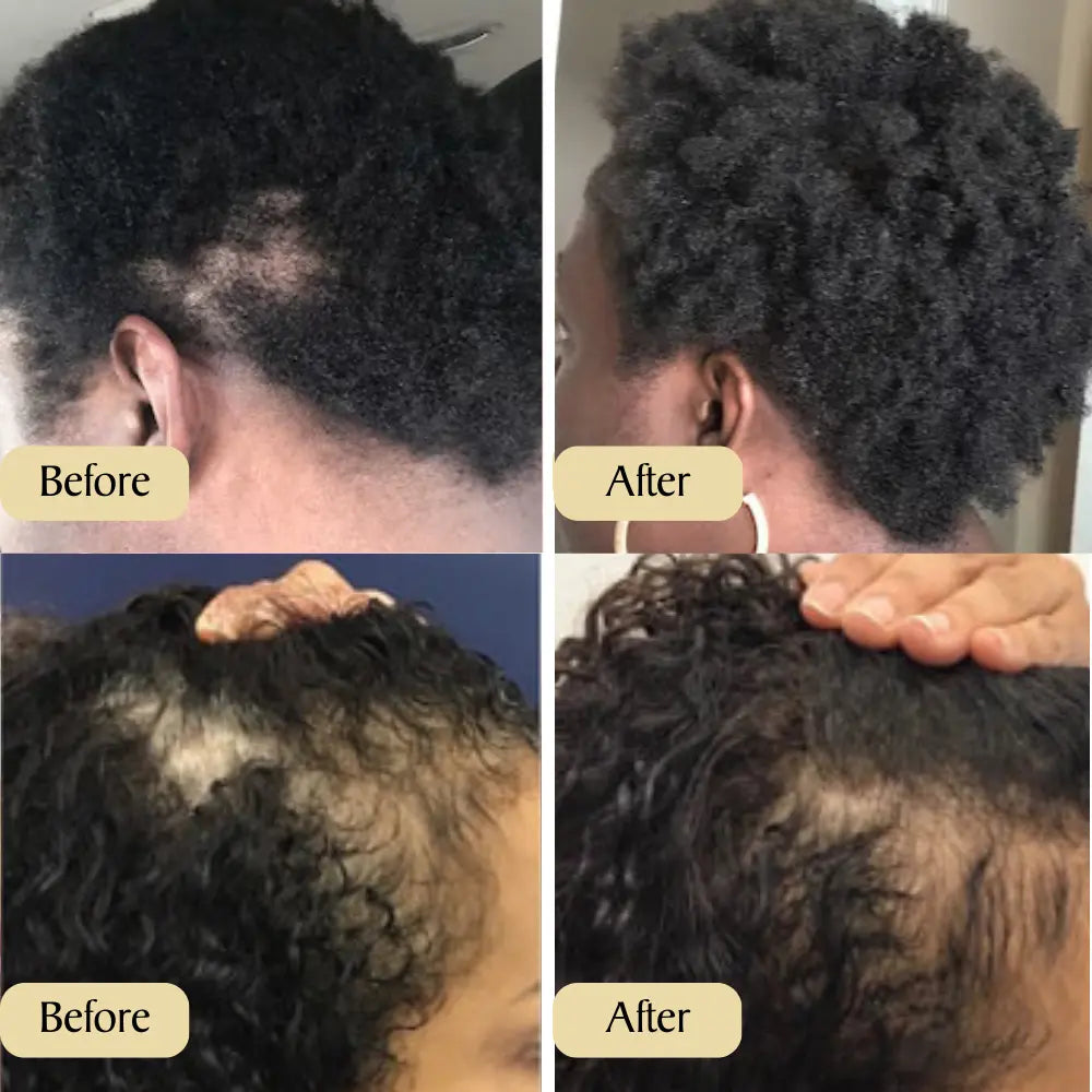 VeganicGrow Natural Hair Growth Oil 1+1 GRATIS Selene Nordic